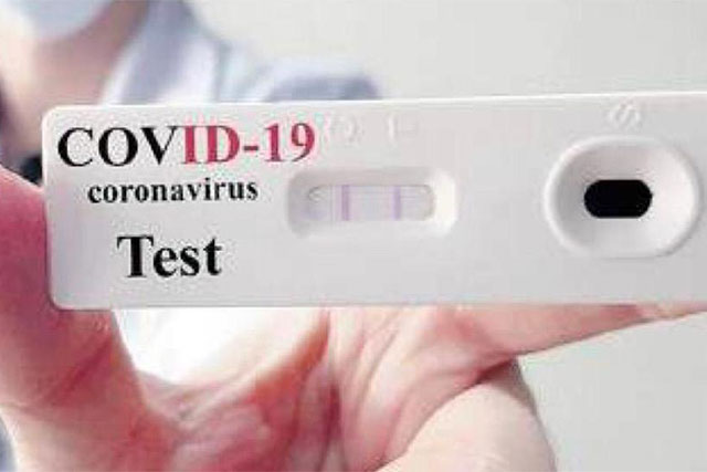 COVID 19 – BIGON E ZOTTIS (PD): “SOLO TAMPONI MOLECOLARI PER IL PERSONALE SANITARIO: TEST RAPIDI CON MARGINE DI ERRORE TROPPO ALTO, SI RISCHIANO ULTERIORI FOCOLAI NEGLI OSPEDALI”