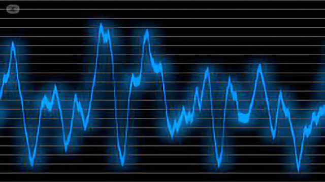 SABATO 14 OTTOBRE ALL’ULSS 4 IL “DOPPLER DAY”