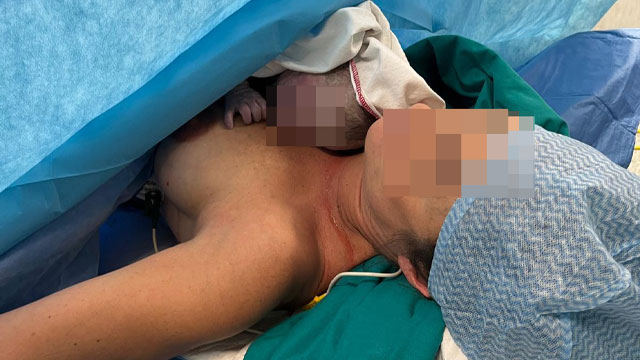 ALL’OSPEDALE DI PORTOGRUARO IL PRIMO “PARTO CESAREO DOLCE”: LA MAMMA VEDE NASCERE E PUÒ SUBITO ABBRACCIARE IL PROPRIO BAMBINO